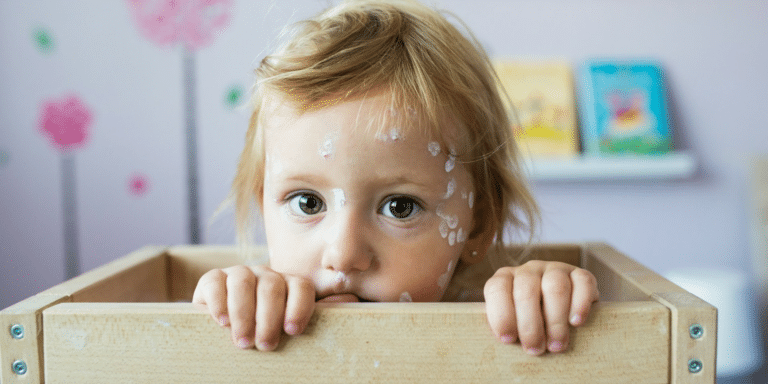 Why You Shouldn't Panic About Chickenpox in Children